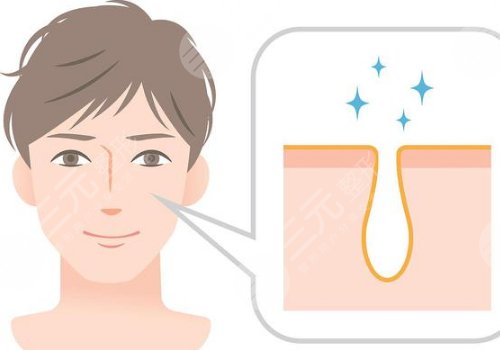 t區(qū)出油毛孔粗大怎么辦？