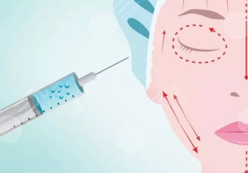 外輪廓固定提升有哪些手術(shù)方案？