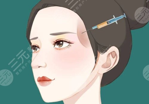 外輪廓提升需要幾支玻尿酸？