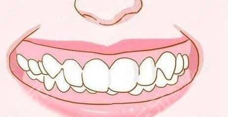 牙齒矯正