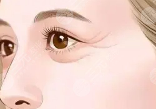 薇旖美可以注射眼部周圍的皺紋不？