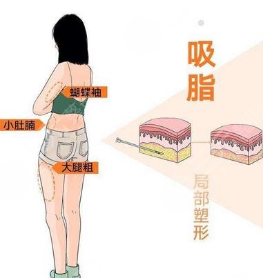 北京世紀壇醫(yī)院整形科擅長項目科普