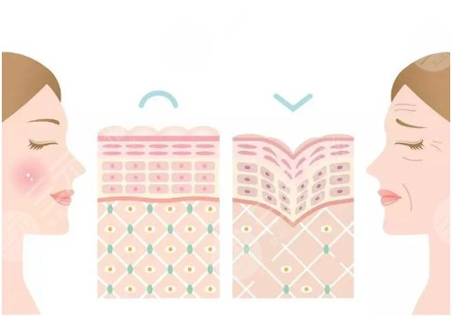 膚美達(dá)和雙美的區(qū)別