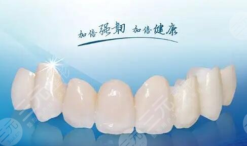 烤瓷牙多少錢一顆價(jià)格表2023查詢！牙齒修復(fù)必備~