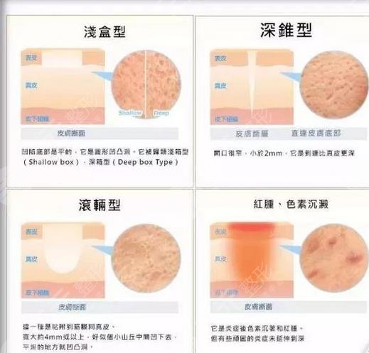 上海華山醫(yī)院點(diǎn)陣激光醫(yī)生介紹