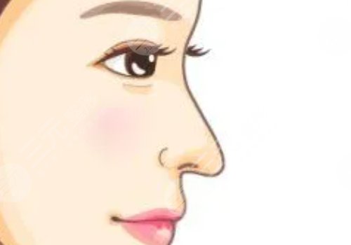 整鼻子鼻翼縮小多少錢