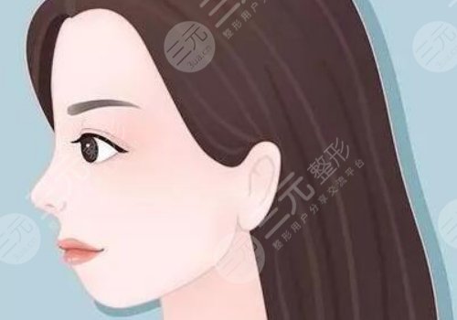 下巴后縮可以矯正過來嗎？