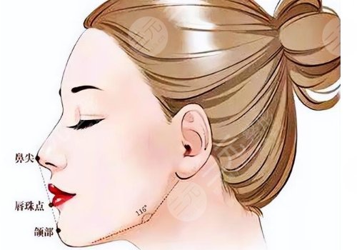 下巴后縮可以矯正過來嗎？