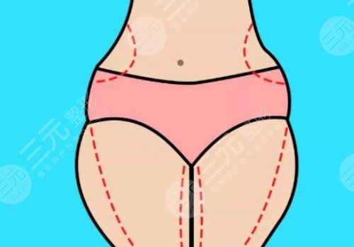 吸脂手術(shù)對身體有哪些危害?