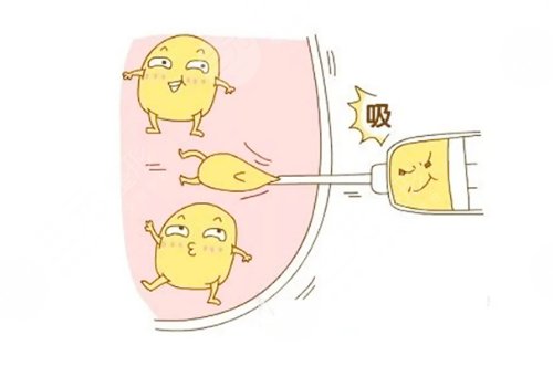 吸脂手術(shù)對身體有哪些危害?