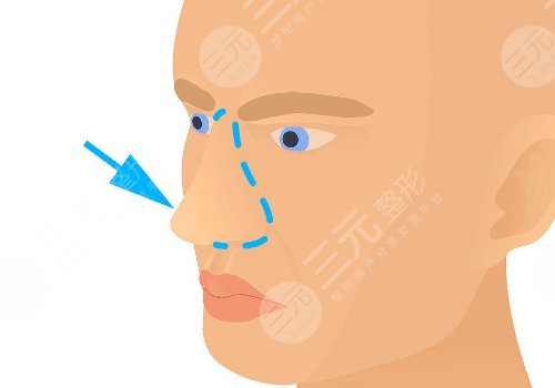 浙江省中醫(yī)院整形科好不好？