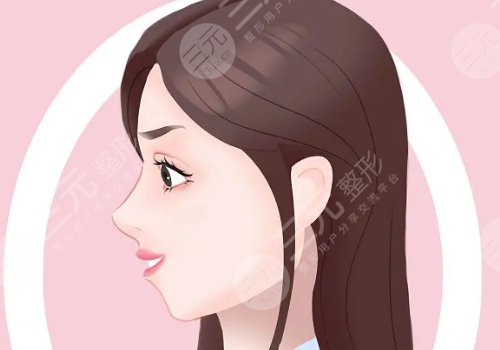 下巴后縮嘴凸怎么改良