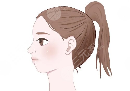 下巴后縮嘴凸怎么改良