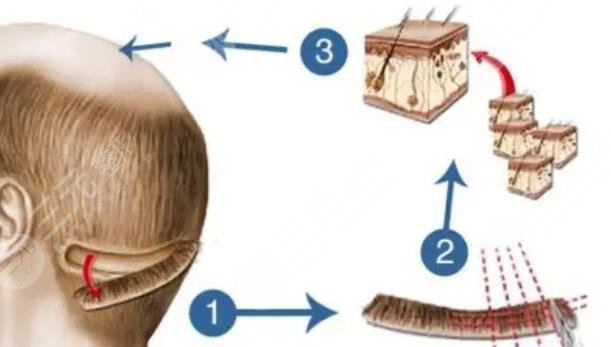 北京大學(xué)深圳醫(yī)院擅長項目科普