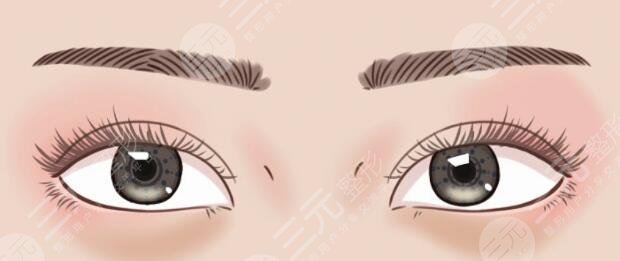 雙眼皮手術