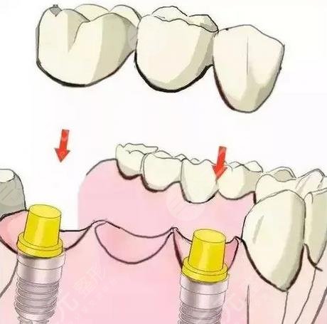 上海仁濟(jì)醫(yī)院口腔科擅長科普知識