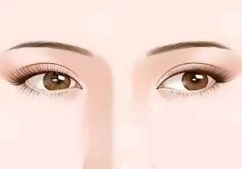 曹仁昌修復(fù)眼睛真的厲害嗎？