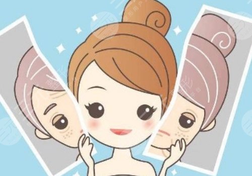 奧地利公主玻尿酸適合打哪里