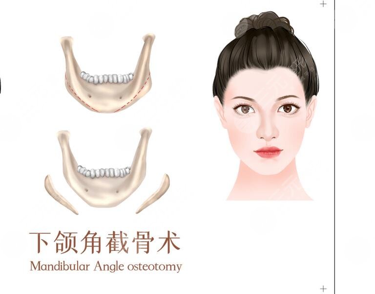 上海第九人民醫(yī)院整形科擅長項目科普
