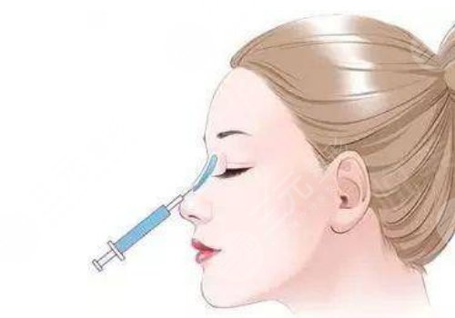 廣州顏玲做鼻子如何？