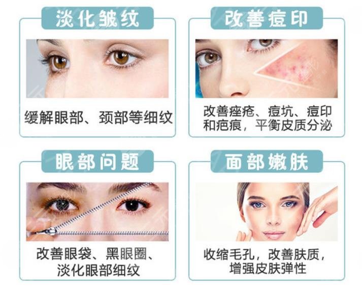 光子嫩膚m22和opt的區(qū)別