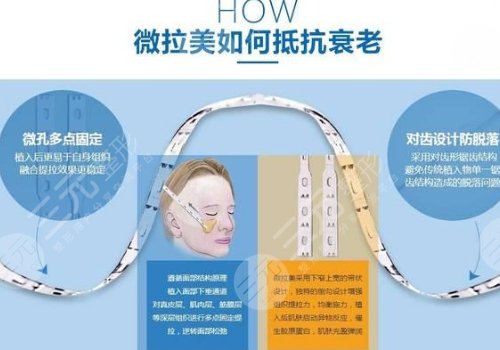 微拉美多少錢(qián)一次