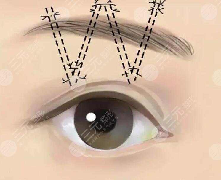 王召東醫(yī)生擅長(zhǎng)項(xiàng)目介紹