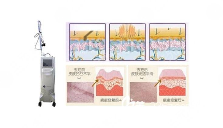 永州中心醫(yī)院美容科擅長項(xiàng)目科普知識(shí)