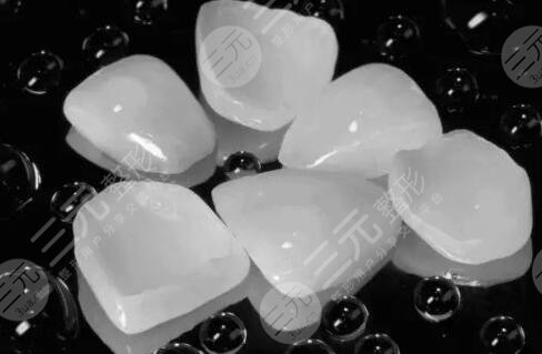 北京協(xié)和醫(yī)院口腔科牙齒貼面案例