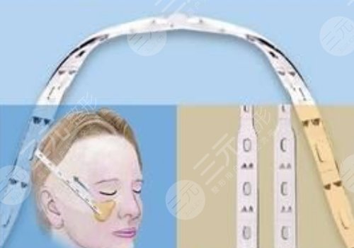 微拉美是什么整容項(xiàng)目