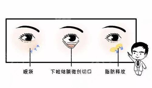 南京去眼袋整形術(shù)的費(fèi)用價(jià)格查詢！3家靠譜醫(yī)院可選~