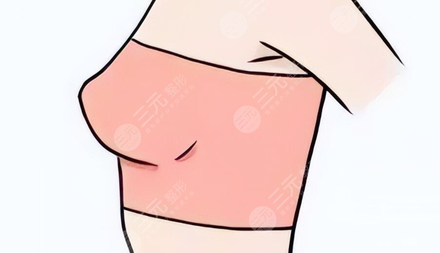 做了假體隆胸會不會癌變？乳腺專家跟蹤調(diào)查后總結~