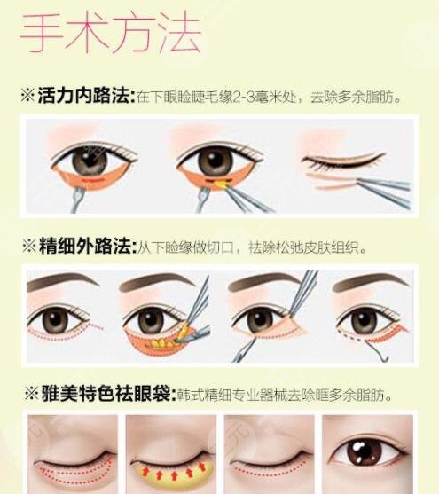 上海九院整復(fù)外科開展項目科普