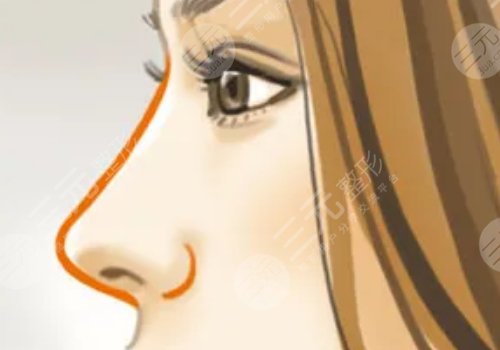 徐士亮做的鼻子好看嗎？