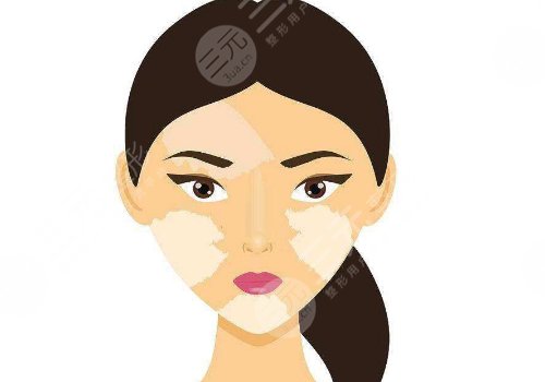 用什么土方治白斑？