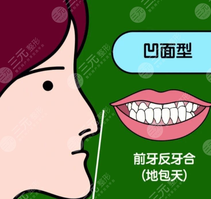 成人地包天手術(shù)整形費(fèi)用多少錢？2023年市場(chǎng)均價(jià)1-3萬(wàn)不等~
