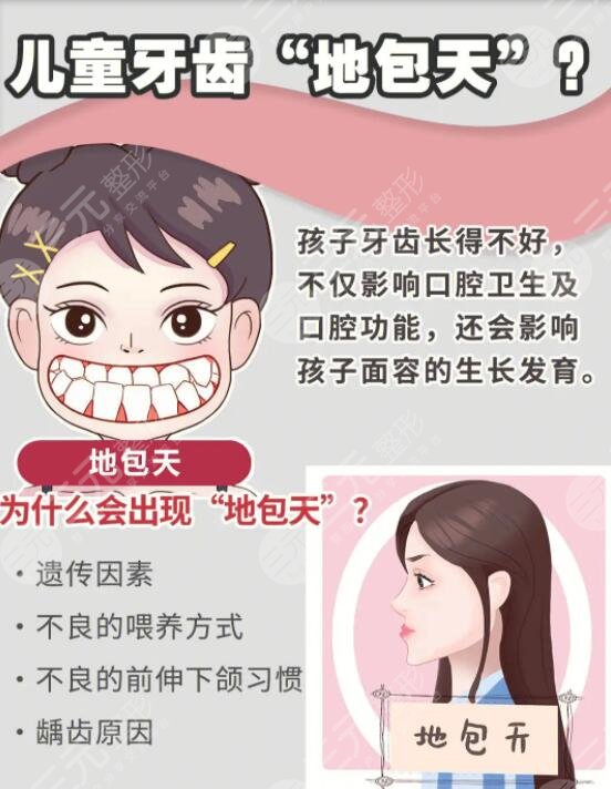 成人地包天手術(shù)整形的方式有哪些?