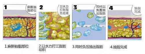 瘦肚子和腰上贅肉有效的方法有哪些？