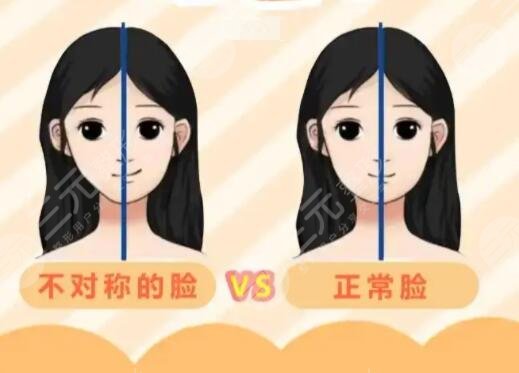 下頜骨一高一低臉歪矯正后需要怎樣護(hù)理?