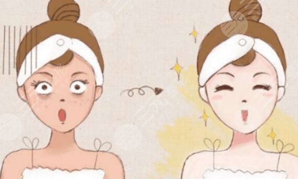 上海華山醫(yī)院整形外科光子嫩膚前后對(duì)比照片