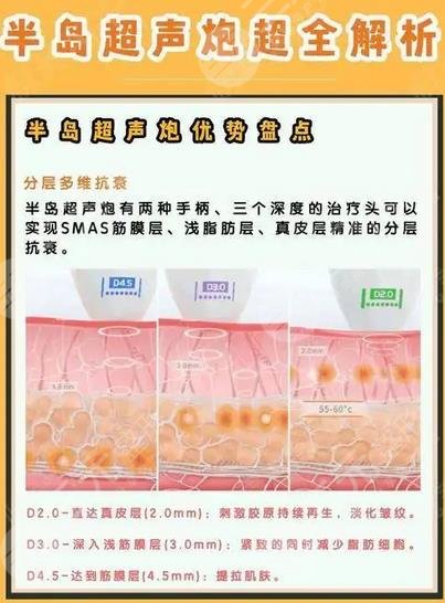 半島黃金超聲炮和超聲炮的區(qū)別有哪些？