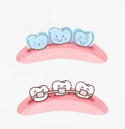 上海六院牙齒矯正掛什么科