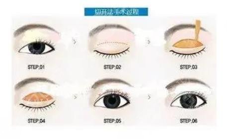 管果醫(yī)生眼修復(fù)案例