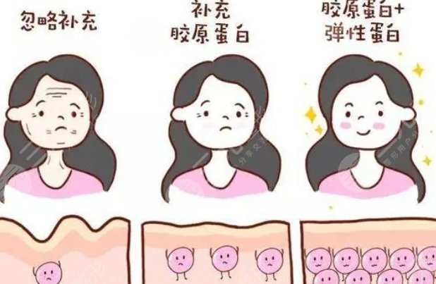 菲林普利膠原蛋白