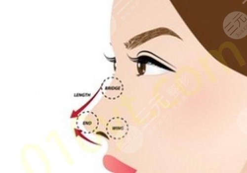 強(qiáng)生瑆珀假體缺點(diǎn)