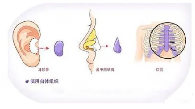 上海談宇騰鼻部綜合案例