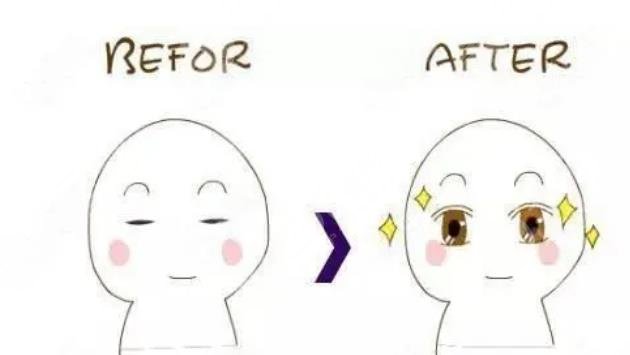 彭才學醫(yī)生雙眼皮案例