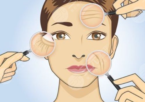 小切口拉皮手術可以維持多久