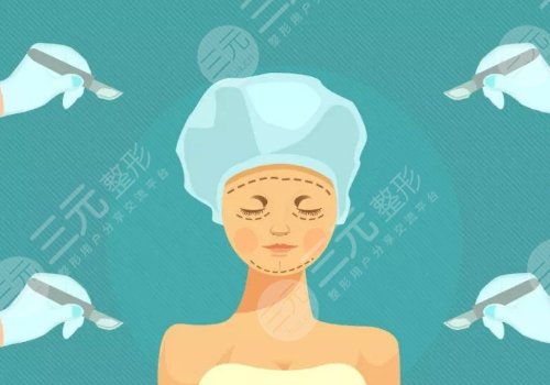 小切口拉皮手術可以維持多久