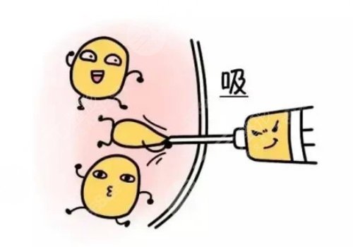 深圳美萊郭杰的抽脂真實水平怎么樣